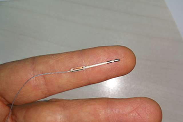Neuro stimulator closeup
