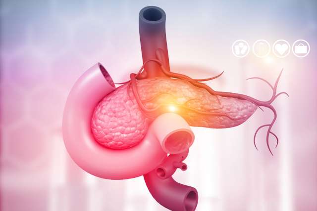 Pancreatic Disease Illustration