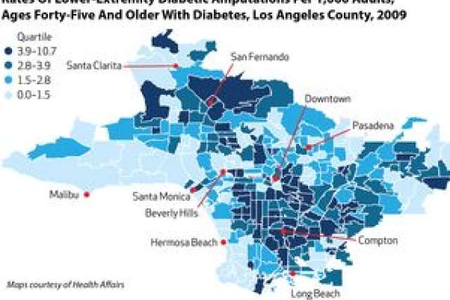 Map showing diabetic amputation rates across Los Angeles County, 2009.
