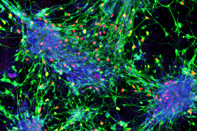 Microscopic image of sensory interneurons derived from mouse cells, showcasing the intricate network of nerve cells with detailed structures under high magnification.