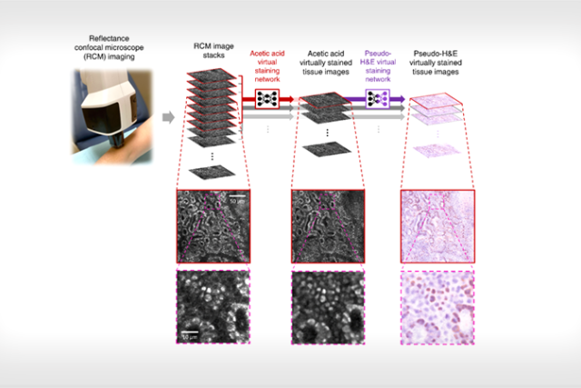 Image of a biopsy-free virtual histology