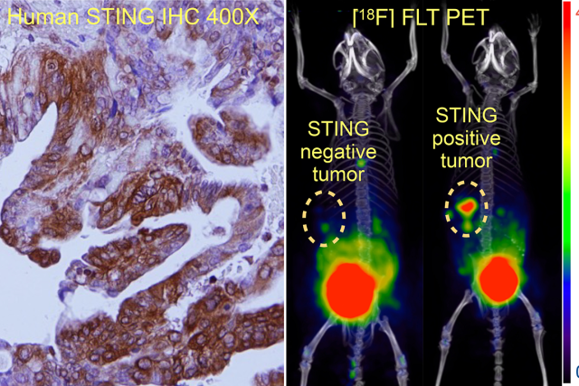 Immunohistochemistry (left) shows brown stained cells. A PET scan (right) of two mice shows one with no tumor activity and another with a red/yellow "STING positive tumor."