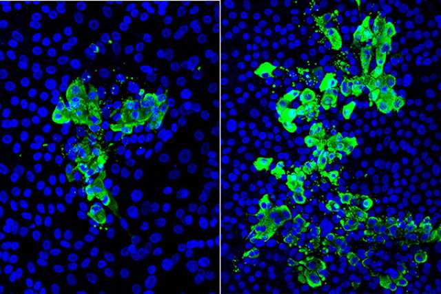 COVID-19-infected cells