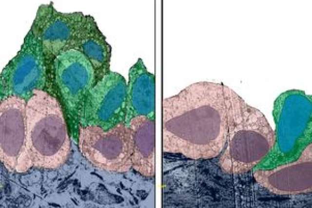 Microscopic image showing cells with varying colors, linked to lung cancer research.
