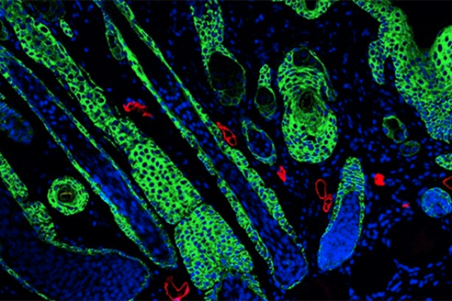 Microscopic image of regenerated hair follicles at the center of a wound treated with a novel hydrogel, with Keratin 5–positive tips of the follicles appearing in green, indicating successful tissue regeneration.