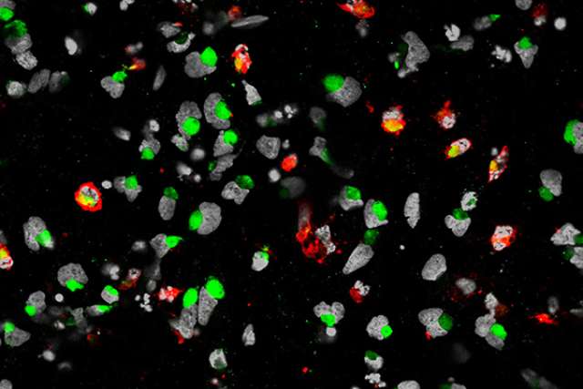 Zika virus infecting cells