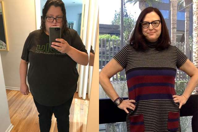 Kristen's Story - Before and After Lap Band Revision