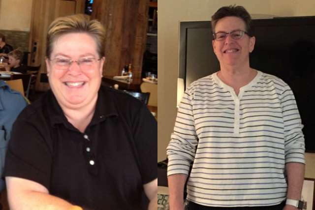 Lynne's Story - Before and After Gastric Bypass Surgery