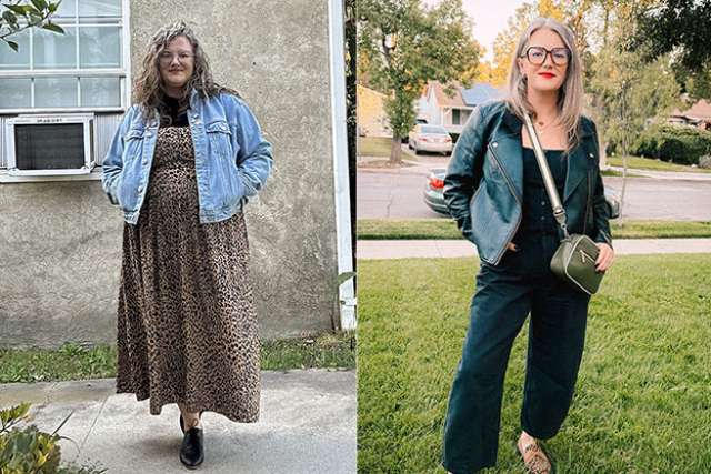 Sam before and after her Gastric Sleeve surgery at UCLA