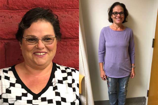 Rubina's Story - Before and After Gastric Sleeve Surgery