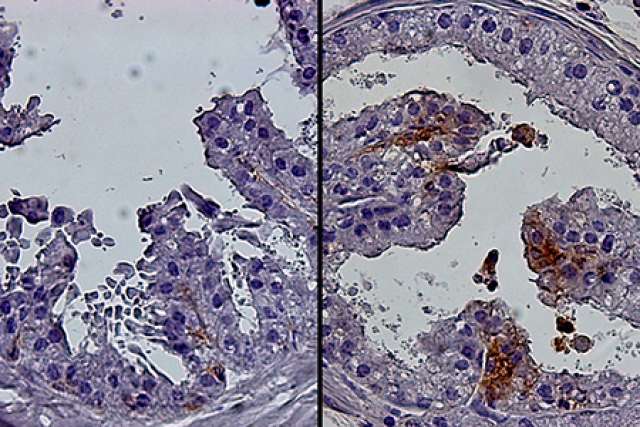 Adult and aged prostate cells