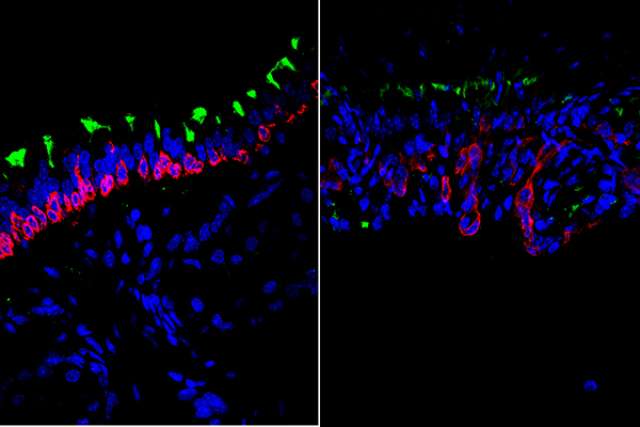 Stem cells in airways