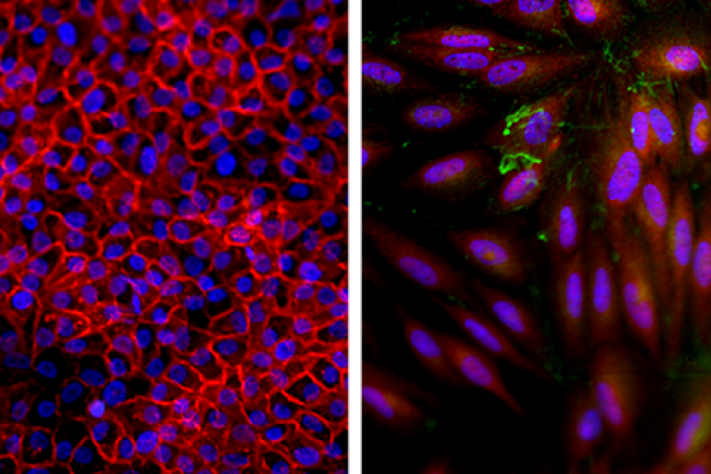 Side by side comparison images, of normal breast and KRAS-variant breast epithelial cells 