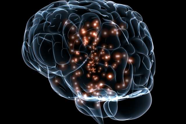 Artists rendering of brain