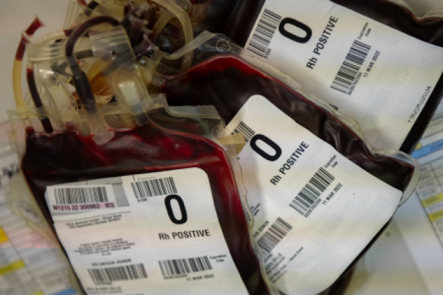  Three bags of "O Rh POSITIVE" blood are visible, with tubing and labels, against a light background.