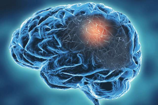Neurodegenerative disease concept illustration. Alzheimer's, Parkinson's disease concept 3d illustration.