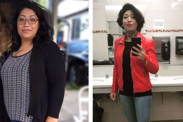 Elizabeth's Story - Before and After Gastric Sleeve Surgery