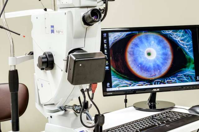 Slit lamp microscope next to a monitor displaying a close-up image of a blue iris.