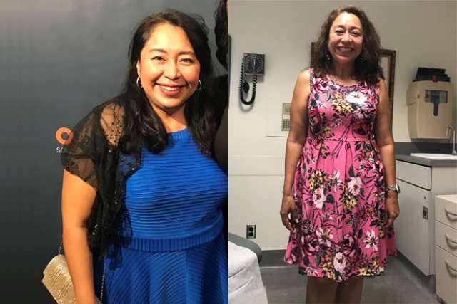 Elsa's Story - Before and After Gastric Sleeve Surgery