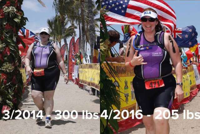 Laura's Story - Before and After Gastric Sleeve Surgery