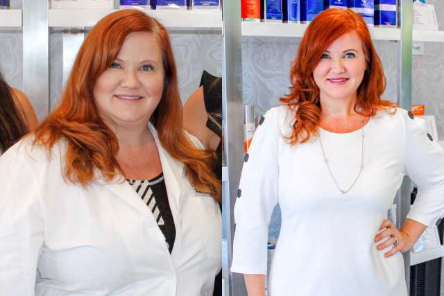 Jennifer's Story - Before and After Gastric Sleeve Surgery