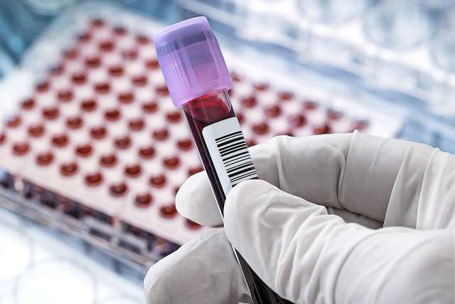 Scientist preparing blood sample for clinical testing in a laboratory.