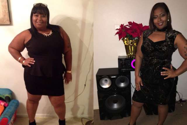 Therese's Story - Before and After Bariatric Surgery