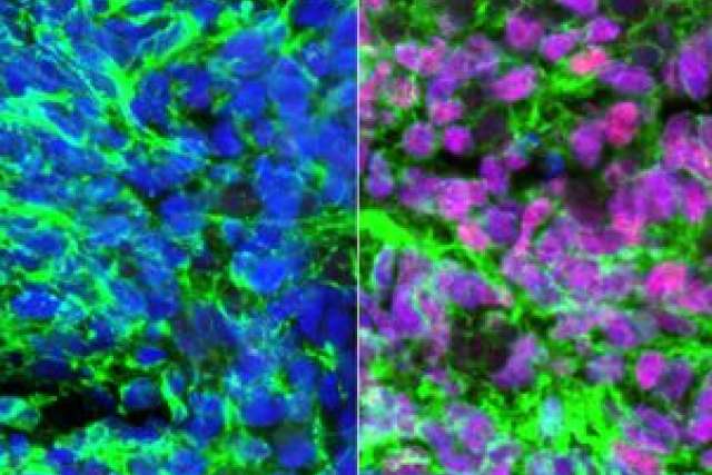 Microscopic image showing two sections with cells in blue and green on the left, pink and green on the right.