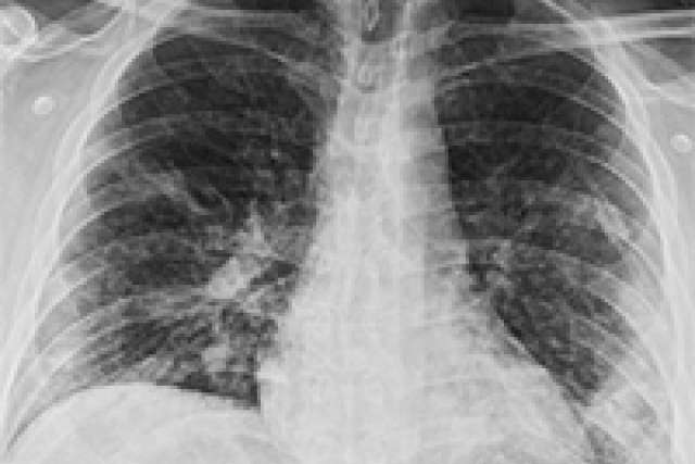 COVID-19 Chest X-Ray Guidelines