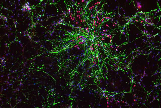 Fluorescence microscopy image showing a dense network of branching astrocytes in green, interspersed with red intermediate progenitor cells against a dark background.