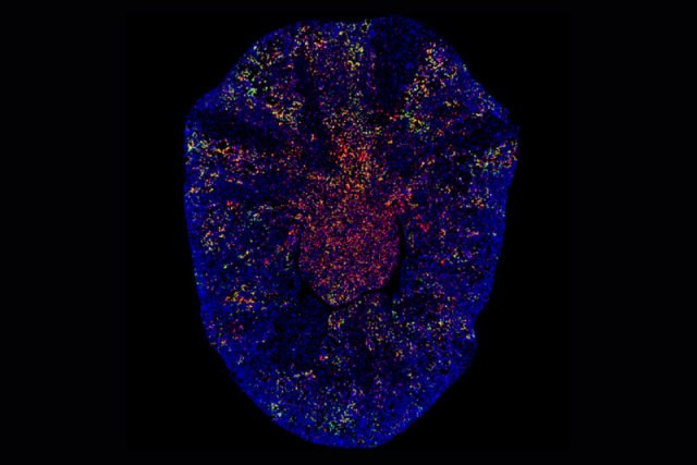 Fluorescent imaging of fibrotic kidney scar tissue.