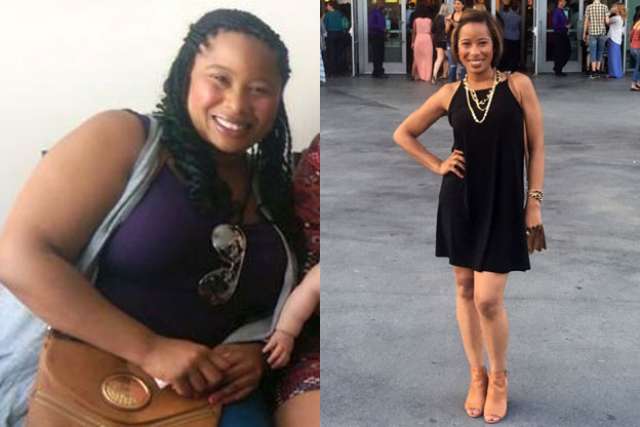 Sheena's Story - Before and After Gastric Sleeve Surgery