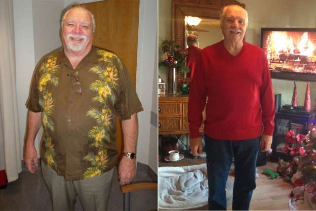Robert's Story - Before and After Gastric Sleeve Surgery