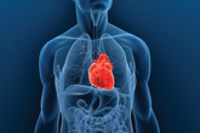 CAV is a condition that affects transplanted hearts and can limit long-term survival.