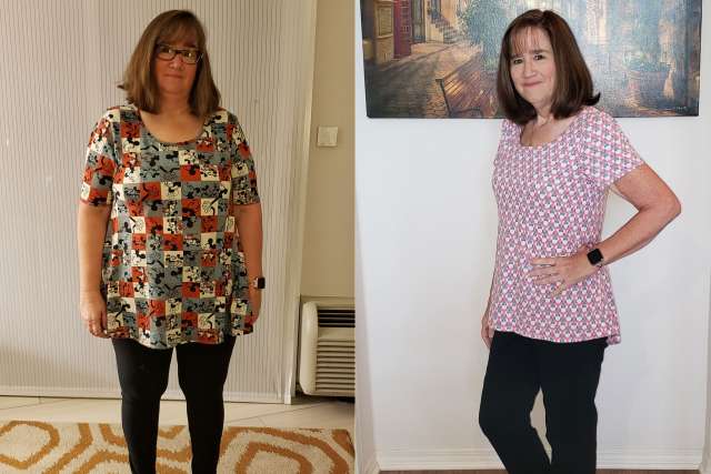 Charlotte's Story - Before and After Gastric Sleeve Surgery