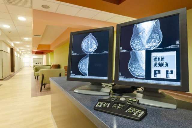 Mammogram