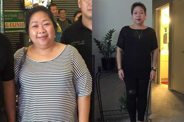 Mervilyn's Story - Before and After Gastric Bypass Surgery