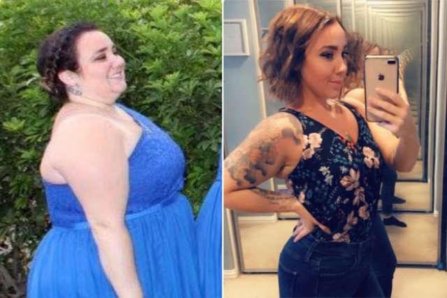 Tara's Story - Before and After Gastric Sleeve Surgery