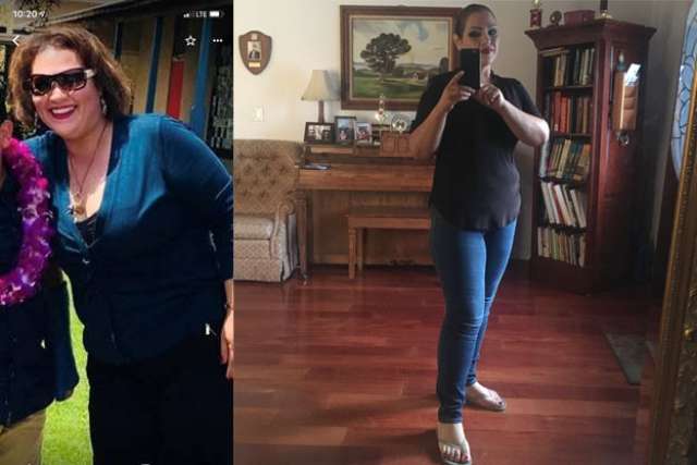 Maria's Story - Before and After Gastric Sleeve Surgery