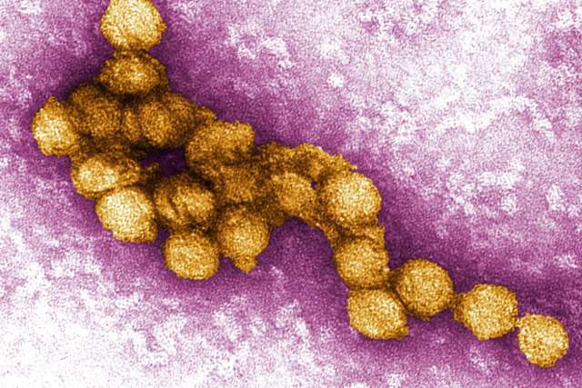 West Nile virus