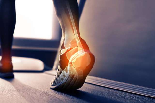 Close-up of a foot on a treadmill with an emphasis on the ankle joint.