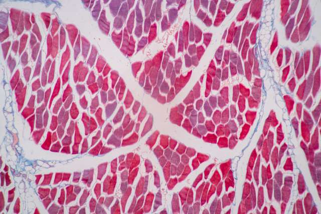 Skeletal muscle of mammal Tissue under the microscope.