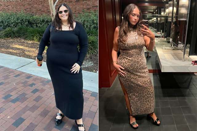 Simonne before and after Gastric Sleeve surgery at UCLA Health