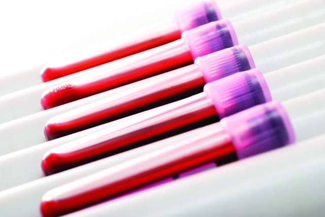 Vials of blood on a rack awaiting testing.