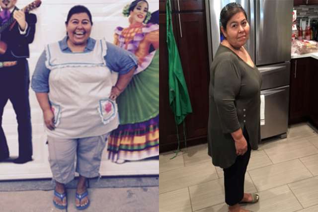 Maria's Story - Before and After Gastric Sleeve Surgery