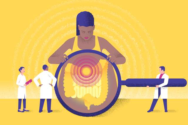 Colon Cancer Illustration - A doctor holding a magnifier over a woman's stomach showing her colon. Two other doctors observing