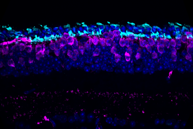 Fluorescent imaging of retinal cells