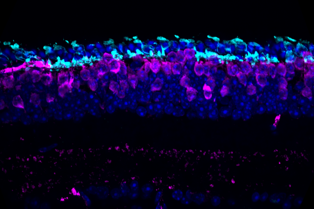 A photo of retinal cells