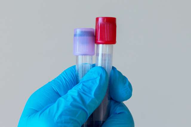 Gloved hand holding test tube