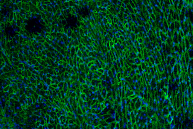 Fluorescent microscopy of muscle tissue showing restored dystrophin protein (green) after gene therapy in muscular dystrophy.